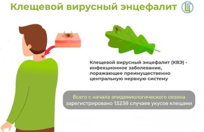 Клещевой энцефалит. Как обезопасить себя и своих близких.