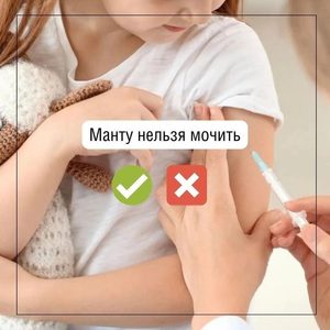 Манту нельзя мочить